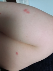 What is biting me? (Photos)