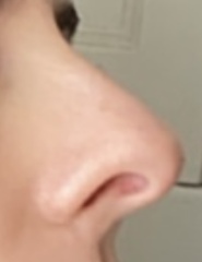 To be in tears over my nose?