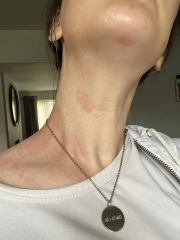 Do I need a second opinion on this? Medication related