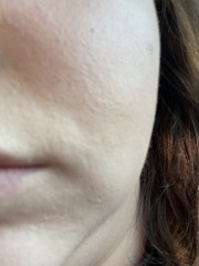 So sick of my dry skin!