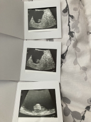 Journey after miscarriage support thread March 2023