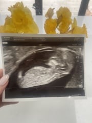 Any guesses on gender?
