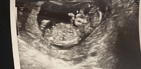 Has anyone been told the gender at 12 week scan?