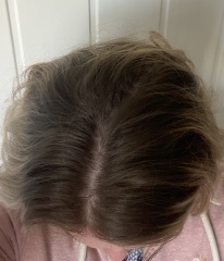 Hair help