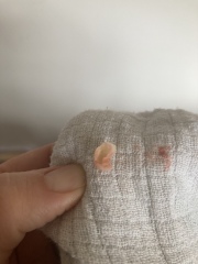 The most brilliant thing just came out of my scalp 😃 (pic included)