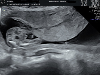 Is this definitely a boy??