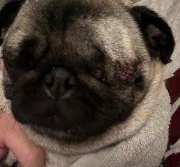 Eye removal day 8 bleeding/torn TW Blood