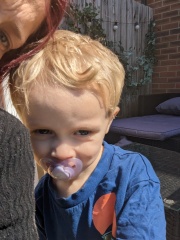 Lumps on sons neck