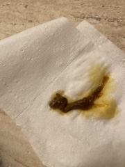 Tissue passed during period includes pic