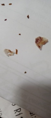 Mucus I've just coughed up - Picture inside