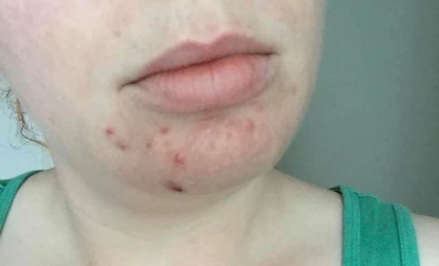 Amazing skin of Alexandra Soveral - genes or products?