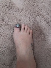 Dropped a door on my toe on Friday...,
