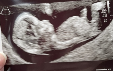 Boy or Girl?