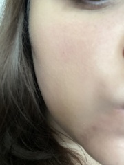 So sick of my dry skin!