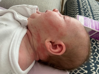 My newborn has a rash and I’m sure what to do?!