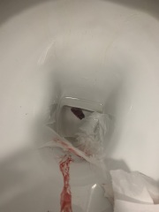 **Warning - graphic pics** - is this my baby that I passed or something else?