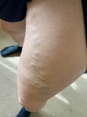 Depressed at the state of my leg