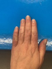 Anyone know what's wrong with my hands