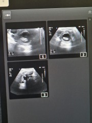 Could this be the nub????