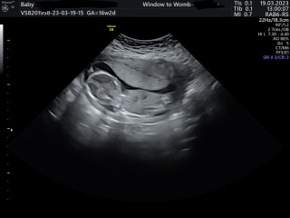 Is this definitely a boy??