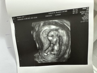 12 weeks ultrasound boy or girl?