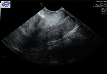 Early scan confusion