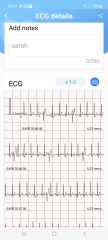 Any nurse/doctors able to interpret ECG?