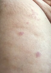 What could this rash be?