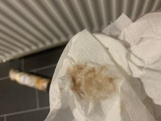 Is this implantation?