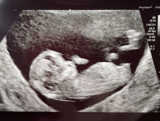 Boy or Girl?