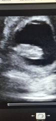 What is this? 10 weeks pregnant
