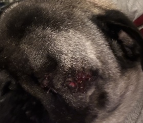 Eye removal day 8 bleeding/torn TW Blood