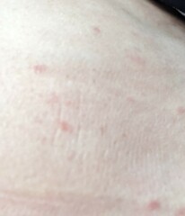 What could this rash be?