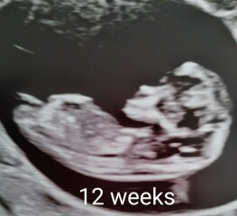 October - into the second trimester!