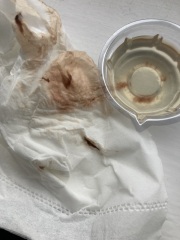 Am I about to miscarry? Pics included TMI
