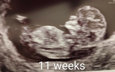October - into the second trimester!