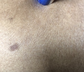 Mark on boob - worried - anyone know what it can be ?