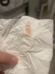Bleeding at 6 weeks tmi pictures 