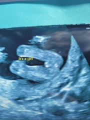Did they tell us the wrong gender?