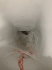 **Warning - graphic pics** - is this my baby that I passed or something else?