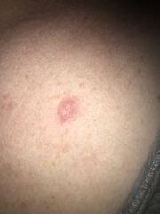 Strange lump? 