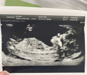 Nub theory guesses? 👶🏼♥️