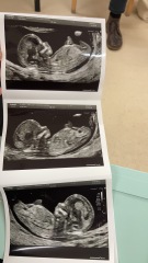 Any guesses on gender