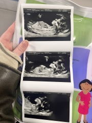 Nub theory guesses? 👶🏼♥️