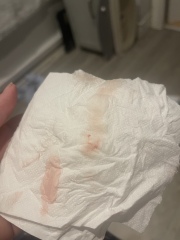 Bleeding at 6 weeks tmi pictures 