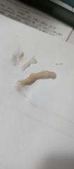 Mucus I've just coughed up - Picture inside