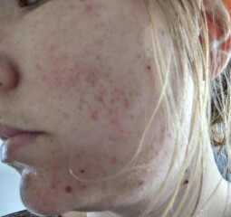 Help! My skin is awful