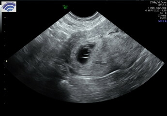 Early scan confusion