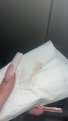 Implantation bleeding? TMI