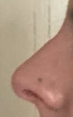 To be in tears over my nose?